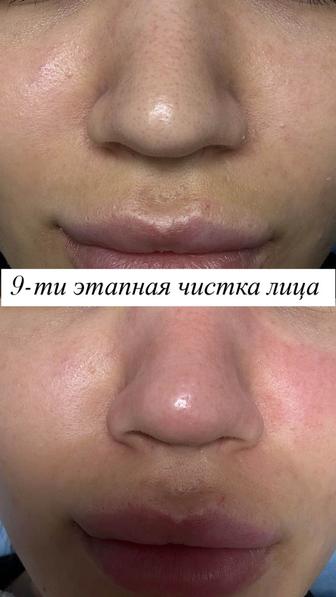 Требуются модели БЕСПЛАТНО на чистку лица массаж