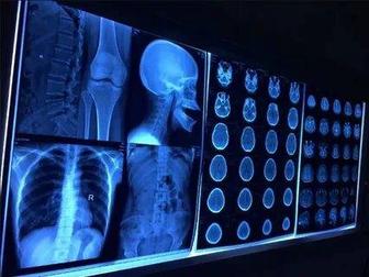 Рентген Плёнка Утилизация