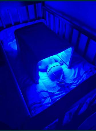 Аренда лампы Кювез от желтушности у новорожденных
