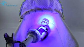 Фотолампы для лечение желтухи у новорожднных