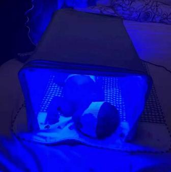 Аренда фотолампы кювез от желтушки новорожденным! Измерения билитестом