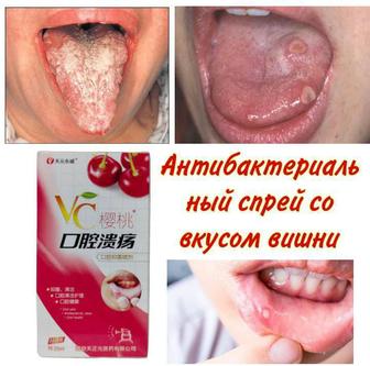 Спрей для полости рта при различных заболеваниях