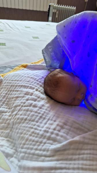 Фотолампа для лечение желтухи новорожднных