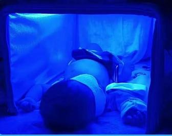 Аренда фотолампы кювейз от желтушности у новорожденных